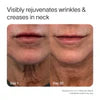 4-in-1 Skincare Wand Kit